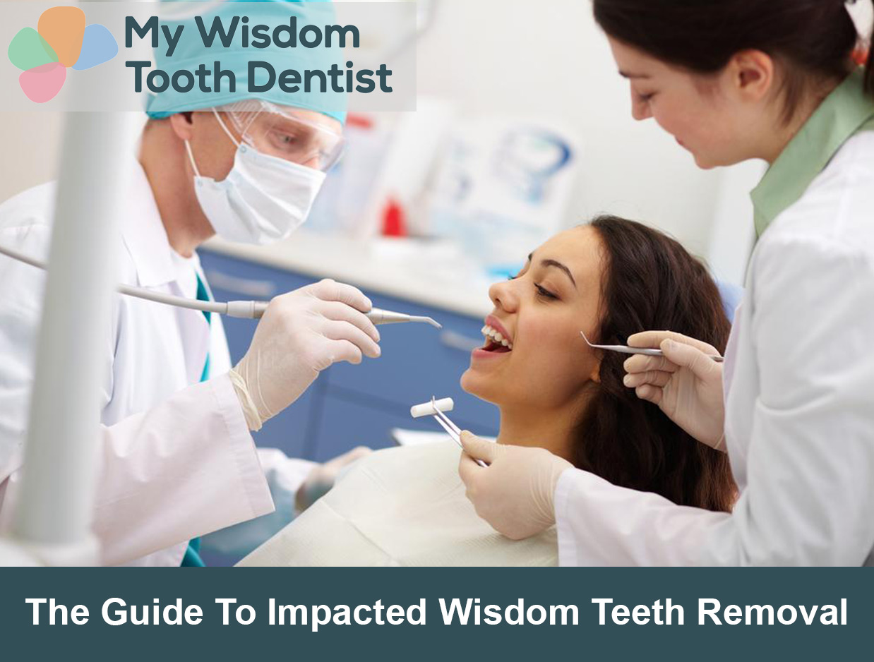 The Guide To Impacted Wisdom Teeth Removal